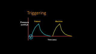 Triggering
Time (sec)
Patient Machine
Pressure
(cmH20)
 