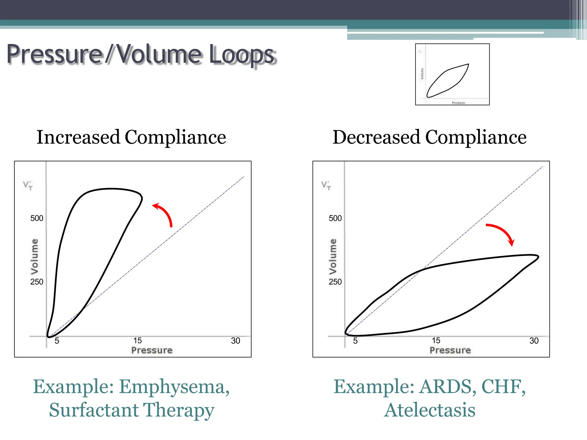 Ventilation Graph Human ventilator graphics in the ICU Patients ppt.pptx