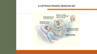 FLOW RATES DAN FLOW
PEAK
ILUSTRASI PASIEN DENGAN MV
 