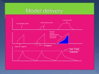 Large Insp effort

No inspiratory effort

Small inspiratory effort

Reduced
pressure
indicates patient
effort during
inspirations

Machine Triggered

Pt-triggered

Set Tidal
Volume

 