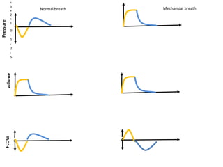 volume
0
-
1
-
2
-
5
Pressure +
3
+
2
+
1
FLOW Normal breath Mechanical breath
 