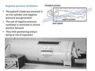 Negative pressure ventilation
• The patient's body was encased in
an iron cylinder and negative
pressure was generated
• The use of negative pressure
ventilator is restricted in clinical
practice because
• They limit positioning and p.t
being at risk of aspiration
 