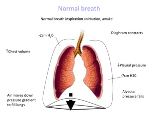 Normal breath inspiration animation, awake
Diaghram contracts
Chest volume
Pleural pressure
Air moves down
pressure gradient
to fill lungs
-2cm H20
-7cm H20
Alveolar
pressure falls
Normal breath
 