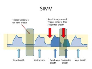 SIMV
Trigger window 1
for Vent breath
Vent breath Vent breath Synch Vent Supported Vent breath
breath breath
Spont breath sensed
Trigger window 2 for
supported breath
 
