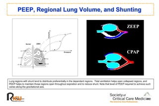PEEP, Regional Lung Volume, and Shunting
ZEEP
CPAP
Lung regions with shunt tend to distribute preferentially in the dependent regions. Tidal ventilation helps open collapsed regions, and
PEEP helps to maintain those regions open throughout expiration and to reduce shunt. Note that level of PEEP required to achieve such
varies along the gravitational axis.
41
 