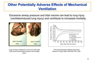 Other Potentially Adverse Effects of Mechanical
Ventilation
Excessive airway pressure and tidal volume can lead to lung injury
(ventilatorinduced lung injury) and contribute to increased mortality.
The Acute Respiratory Distress Syndrome
Network. N Engl J Med. 2000;342:1301-1308.
Lungs of dogs ventilated for a few hours with large
tidal volume demonstrate extensive hemorrhagic
injury.
9
 