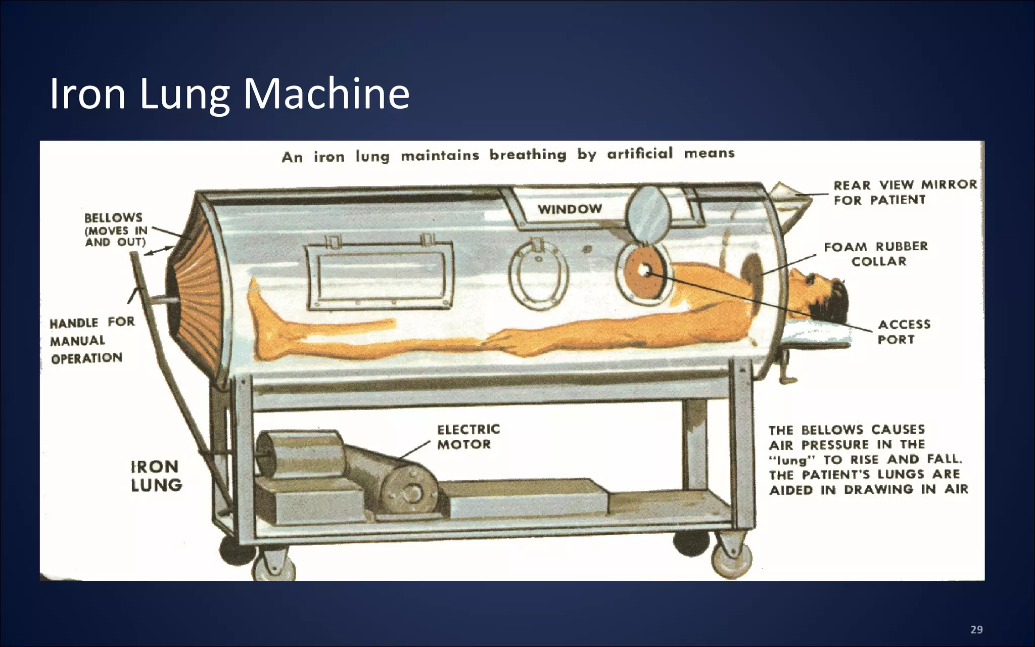 Iron Lung Machine
 