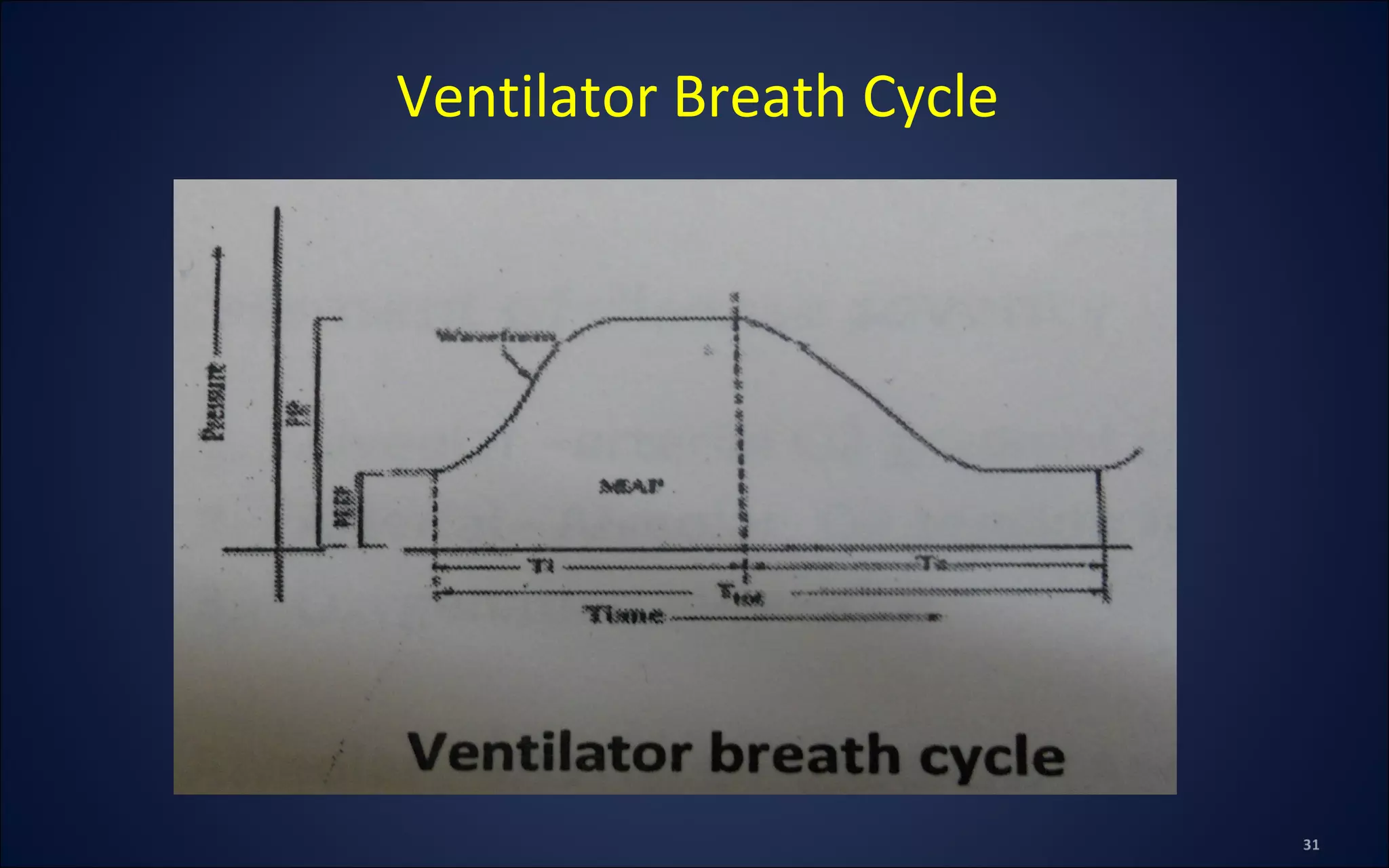 Ventilator Breath Cycle
 