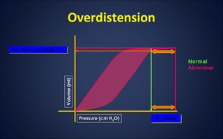Overdistension
Volume(ml)
Pressure (cm HPressure (cm H22O)O)
With little or no change in VT
With little or no change in VT
Paw risesPaw rises
Normal
Abnormal
 