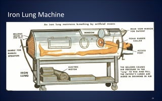 Iron Lung Machine
 
