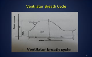 Ventilator Breath Cycle
 