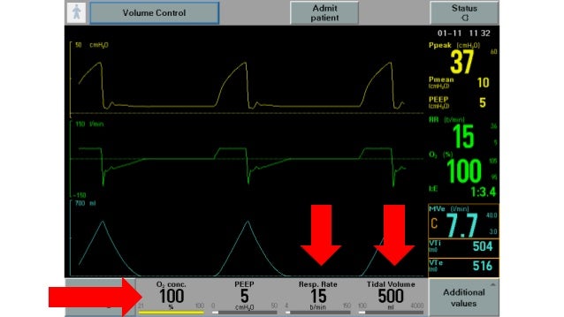 Settings Use and Maintenance of Mechanical Ventilator