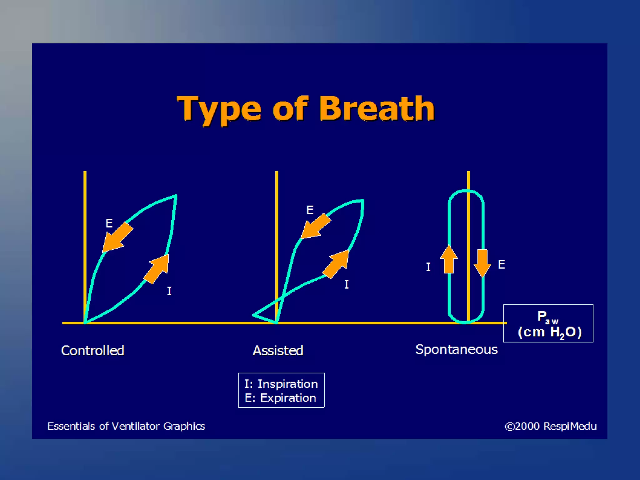 ventilator waveforms Dr Sanjay Chugh.pptx