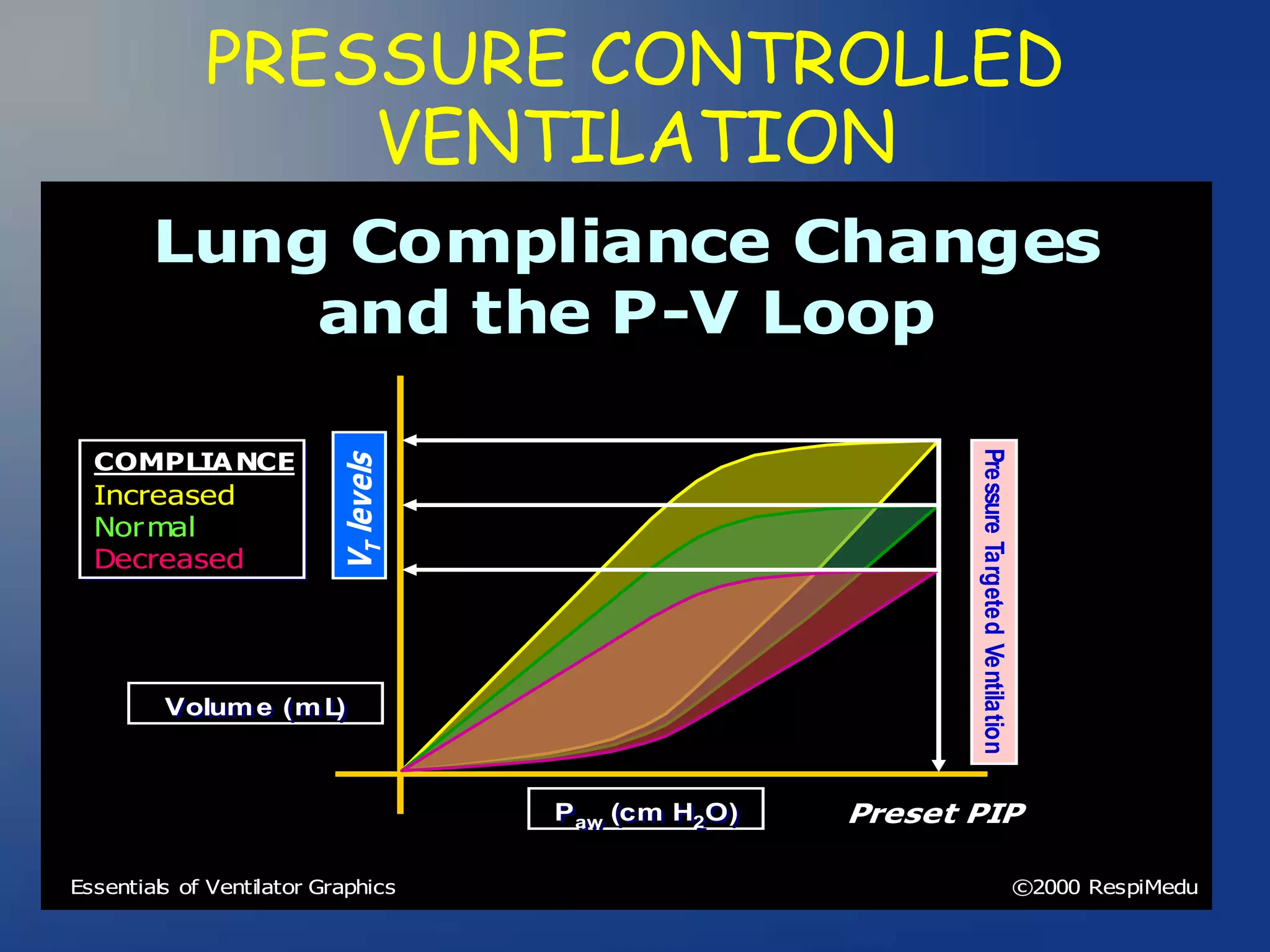 Ventilator Waveforms Dr Sanjay Chugh pptx Ventilator Waveforms Dr Sanjay Chugh pptx
