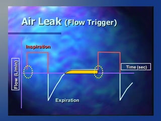 ventilator waveforms Dr Sanjay Chugh.pptx