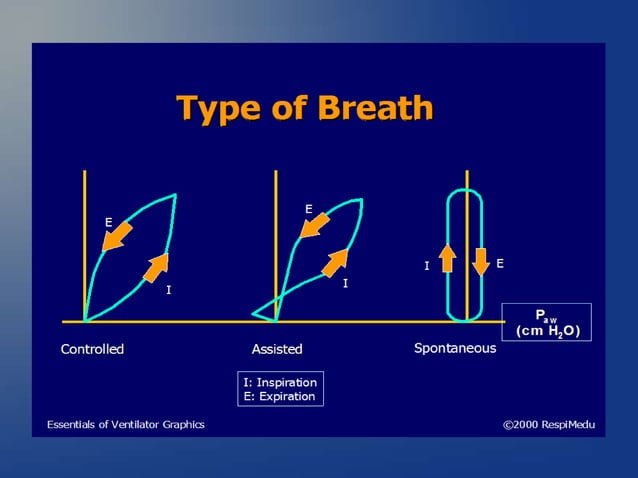 ventilator waveforms Dr Sanjay Chugh.pptx | Lung and Respiratory Health ...