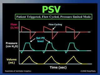 ventilator waveforms Dr Sanjay Chugh.pptx