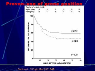 Proven–use of prone position GattinoniL. N EnglJ Med.2001; 345: 