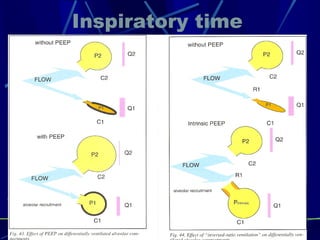 Inspiratory time 