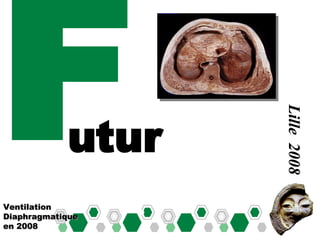 F Ventilation Diaphragmatique en 2008 Lille  2008 utur 