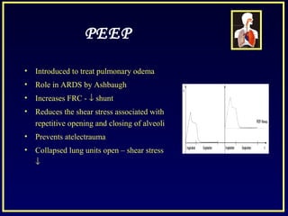 PEEP
• Introduced to treat pulmonary odema
• Role in ARDS by Ashbaugh
• Increases FRC - ↓ shunt
• Reduces the shear stress associated with
repetitive opening and closing of alveoli
• Prevents atelectrauma
• Collapsed lung units open – shear stress
↓
 