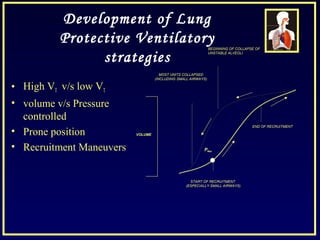 Development of Lung
Protective Ventilatory
strategies
• High VT v/s low VT
• volume v/s Pressure
controlled
• Prone position
• Recruitment Maneuvers
BEGINNING OF COLLAPSE OF
UNSTABLE ALVEOLI
MOST UNITS COLLAPSED
(INCLUDING SMALL AIRWAYS)
START OF RECRUITMENT
(ESPECIALLY SMALL AIRWAYS)
END OF RECRUITMENT
Pflex
VOLUME
 
