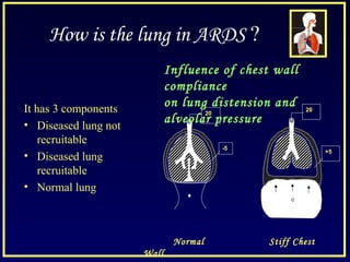 How is the lung in ARDS ?
It has 3 components
• Diseased lung not
recruitable
• Diseased lung
recruitable
• Normal lung
20
-5
20
+5
Influence of chest wall
compliance
on lung distension and
alveolar pressure
Normal Stiff Chest
Wall
 