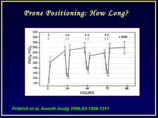 Prone Positioning: How Long?
Fridrich et al, Anesth Analg 1996;83:1206-1211
 
