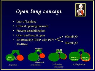 Open lung concept
• Law of Laplace
• Critical opening pressure
• Prevent destabilization
• Open and keep it open
• 30-40cmH2O PEEP with PCV
30-40sec
60cmH2O
40cmH2O
PEEP
5cm H2O
PIP 30 cm
H2O
150 cm H2O
1. Expiration 2. Inspiration
PIP 50
cm H2O
PEEP 12
cm H2O
PEEP 12
cm H2O
3. Opening
procedure
4. Expiration
 