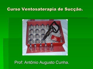Curso Ventosaterapia de Sucção.
Prof: Antônio Augusto Cunha.
 