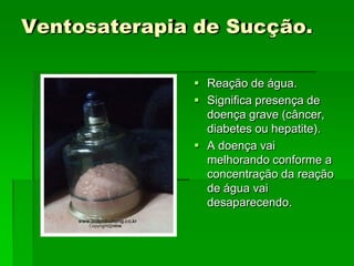 Ventosaterapia de Sucção.
 Reação de água.
 Significa presença de
doença grave (câncer,
diabetes ou hepatite).
 A doença vai
melhorando conforme a
concentração da reação
de água vai
desaparecendo.
 
