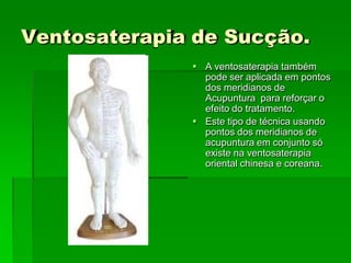 Ventosaterapia de Sucção.
 A ventosaterapia também
pode ser aplicada em pontos
dos meridianos de
Acupuntura para reforçar o
efeito do tratamento.
 Este tipo de técnica usando
pontos dos meridianos de
acupuntura em conjunto só
existe na ventosaterapia
oriental chinesa e coreana.
 
