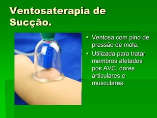 Ventosaterapia de
Sucção.
 Ventosa com pino de
pressão de mola.
 Utilizada para tratar
membros afetados
pos AVC, dores
articulares e
musculares.
 