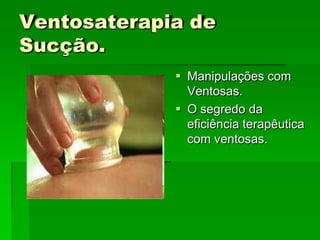 Ventosaterapia de
Sucção.
 Manipulações com
Ventosas.
 O segredo da
eficiência terapêutica
com ventosas.
 