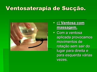 Ventosaterapia de Sucção.
 c) Ventosa com
massagem.
 Com a ventosa
aplicada provocamos
movimentos de
rotação sem sair do
lugar para direita e
para esquerda várias
vezes.
 
