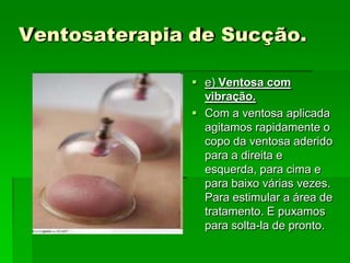 Ventosaterapia de Sucção.
 e) Ventosa com
vibração.
 Com a ventosa aplicada
agitamos rapidamente o
copo da ventosa aderido
para a direita e
esquerda, para cima e
para baixo várias vezes.
Para estimular a área de
tratamento. E puxamos
para solta-la de pronto.
 