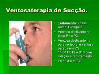 Ventosaterapia de Sucção.
 Tratamento: Tosse,
Asma, Bronquite.
 Ventosa deslizante no
peito P1 e P2.
 Ventosa deslizante na
para vertebral e ventosa
parada em VG
14,B11,B12 e B13 com
rotação e repuxamento.
 P5 e CS6 e E36.
 