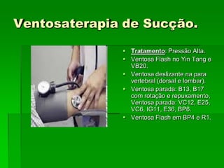 Ventosaterapia de Sucção.
 Tratamento: Pressão Alta.
 Ventosa Flash no Yin Tang e
VB20.
 Ventosa deslizante na para
vertebral (dorsal e lombar).
 Ventosa parada: B13, B17
com rotação e repuxamento,
Ventosa parada: VC12, E25,
VC6, IG11, E36, BP6.
 Ventosa Flash em BP4 e R1.
 