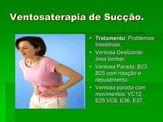 Ventosaterapia de Sucção.
 Tratamento: Problemas
Intestinais.
 Ventosa Deslizante:
área lombar.
 Ventosa Parada: B23,
B25 com rotação e
repuxamento.
 Ventosa parada com
movimentos: VC12,
E25,VC6, E36, E37.
 