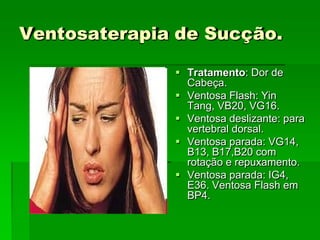 Ventosaterapia de Sucção.
 Tratamento: Dor de
Cabeça.
 Ventosa Flash: Yin
Tang, VB20, VG16.
 Ventosa deslizante: para
vertebral dorsal.
 Ventosa parada: VG14,
B13, B17,B20 com
rotação e repuxamento.
 Ventosa parada: IG4,
E36. Ventosa Flash em
BP4.
 