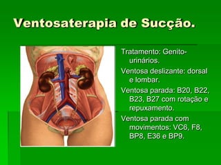 Ventosaterapia de Sucção.
Tratamento: Genito-
urinários.
Ventosa deslizante: dorsal
e lombar.
Ventosa parada: B20, B22,
B23, B27 com rotação e
repuxamento.
Ventosa parada com
movimentos: VC6, F8,
BP8, E36 e BP9.
 
