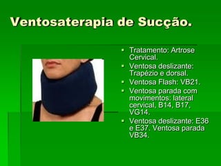 Ventosaterapia de Sucção.
 Tratamento: Artrose
Cervical.
 Ventosa deslizante:
Trapézio e dorsal.
 Ventosa Flash: VB21.
 Ventosa parada com
movimentos: lateral
cervical, B14, B17,
VG14.
 Ventosa deslizante: E36
e E37. Ventosa parada
VB34.
 