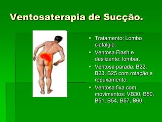 Ventosaterapia de Sucção.
 Tratamento: Lombo
ciatalgia.
 Ventosa Flash e
deslizante: lombar.
 Ventosa parada: B22,
B23, B25 com rotação e
repuxamento.
 Ventosa fixa com
movimentos: VB30, B50,
B51, B54, B57, B60.
 