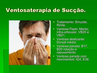 Ventosaterapia de Sucção.
 Tratamento: Sinuzite,
Rinite.
 Ventosa Flash: Mento,
infra-orbicular, VB20 e
VB21.
 Ventosa deslizante:
Dorsal média.
 Ventosa parada: B17,
B20 rotação e
repuxamento.
 Ventosa parada com
movimentos: IG4, E36.
 