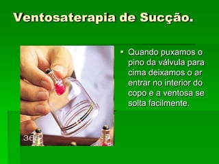 Ventosaterapia de Sucção.
 Quando puxamos o
pino da válvula para
cima deixamos o ar
entrar no interior do
copo e a ventosa se
solta facilmente.
 