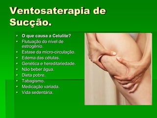 Ventosaterapia de
Sucção.
 O que causa a Celulite?
 Flutuação do nível de
estrogênio.
 Estase da micro-circulação.
 Edema das células.
 Genética e hereditariedade.
 Não beber água.
 Dieta pobre.
 Tabagismo.
 Medicação variada.
 Vida sedentária.
 