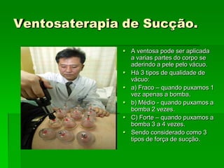 Ventosaterapia de Sucção.
 A ventosa pode ser aplicada
a varias partes do corpo se
aderindo a pele pelo vácuo.
 Há 3 tipos de qualidade de
vácuo:
 a) Fraco – quando puxamos 1
vez apenas a bomba.
 b) Médio - quando puxamos a
bomba 2 vezes.
 C) Forte – quando puxamos a
bomba 3 a 4 vezes.
 Sendo considerado como 3
tipos de força de sucção.
 