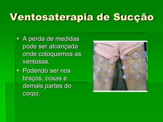 Ventosaterapia de Sucção
 A perda de medidas
pode ser alcançada
onde coloquemos as
ventosas.
 Podendo ser nos
braços, coxas e
demais partes do
corpo.
 