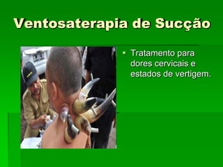 Ventosaterapia de Sucção
 Tratamento para
dores cervicais e
estados de vertigem.
 