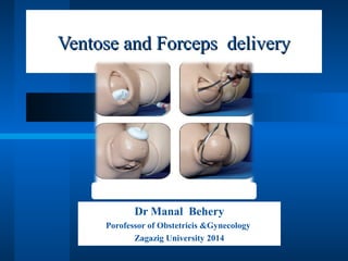 Ventose and Forceps deliveryVentose and Forceps delivery
Dr Manal Behery
Porofessor of Obstetricis &Gynecology
Zagazig University 2014
 